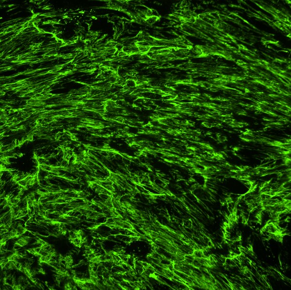 Immunofluorescent (IF) image of human lung fibroblasts with TGF-β treatment labeled with DSHB anti-FN1 [HFN 7.1]. PMID: 39038657, Fig. 3B